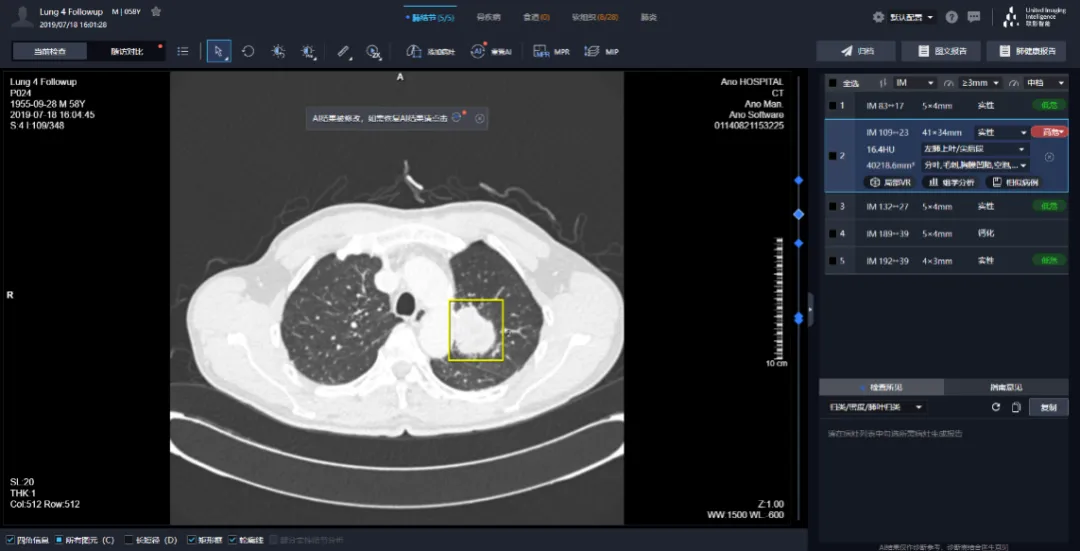 AI助力传统医疗影像诊断困局